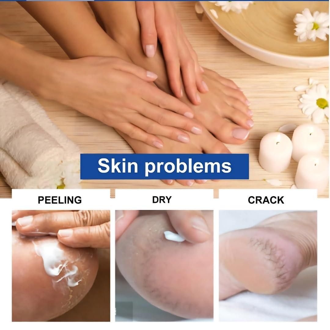 Foot Cream Fast Relief for Fingers & Feet Revive Cream (Pack of 2)